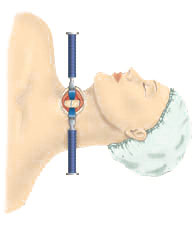 Cervical Artificial Disc