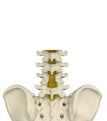 lumbar laminectomy